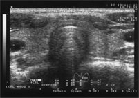 ultrasound2