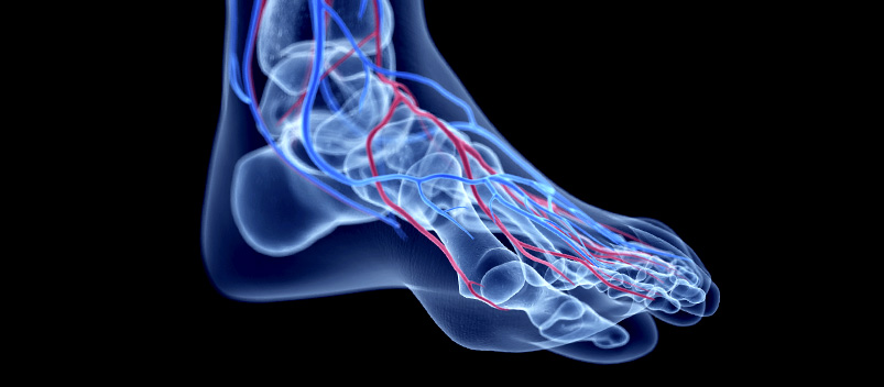 ankle-brachial-index