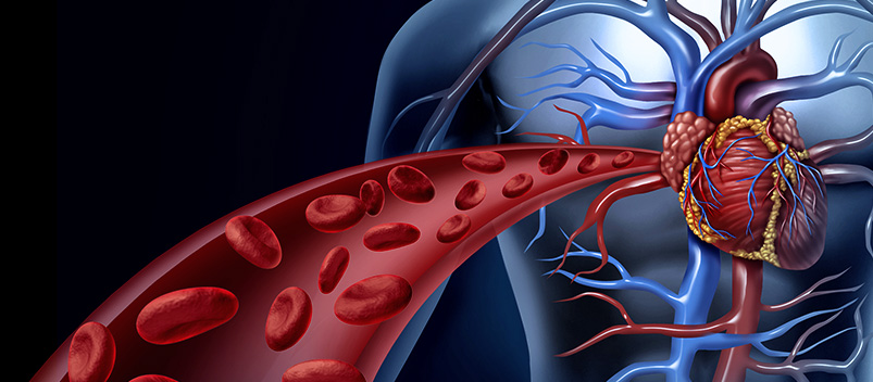 renal-artery-duplex